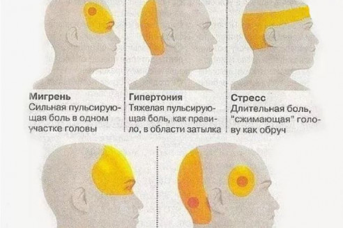 В каком месте болит голова: почему это так важно для вашего здоровья