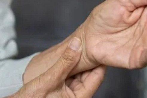 Descubren un análisis de sangre que puede predecir el párkinson