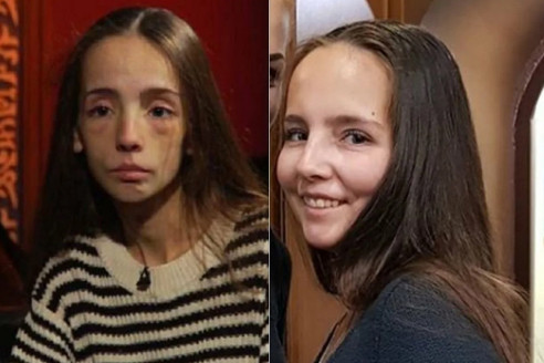 Как травля в школе довела девушку до анорексии и что помогло
