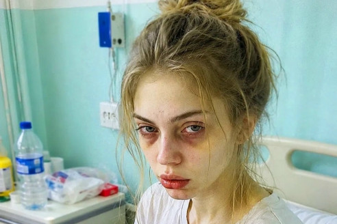 Моя 18-летняя дочь умерла и стала донором органов, но сразу после прощания врач догнал меня в коридоре и раскрыл тайну, которую мой муж умолял скрывать от меня до самого конца.